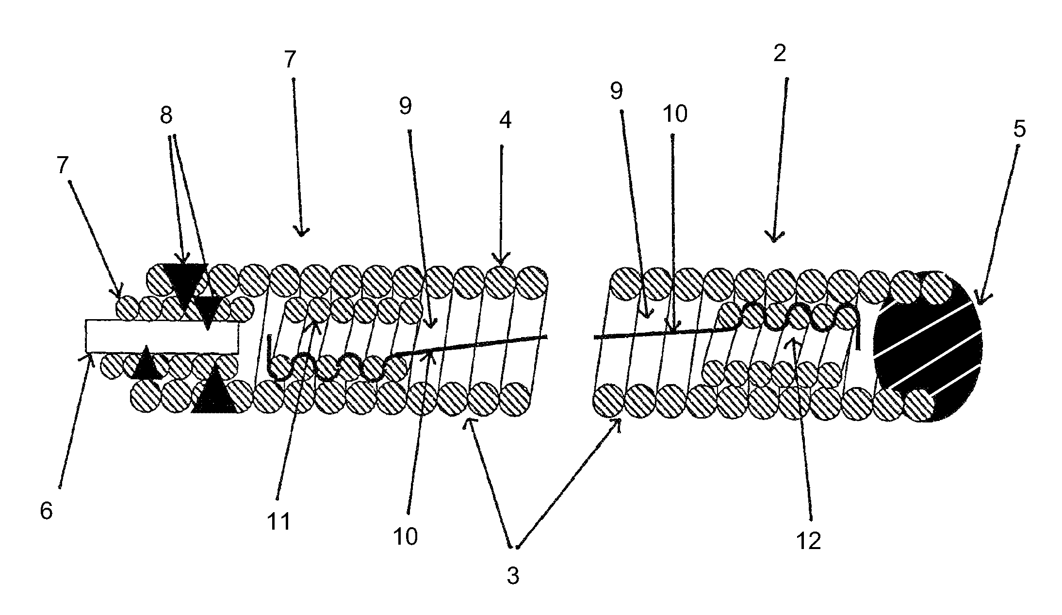 Micro-spiral implantation device