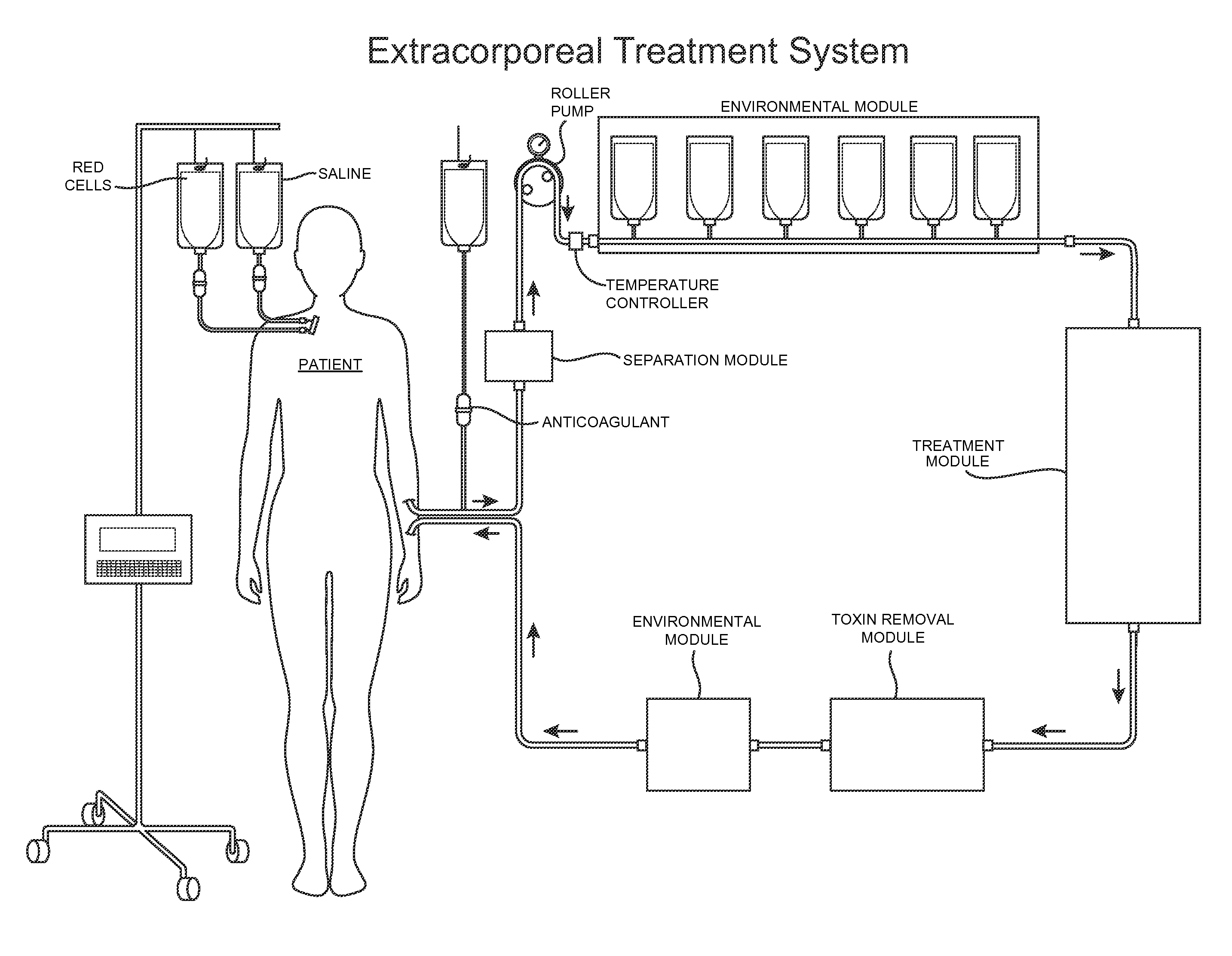 Modular Extracorporeal Systems and Methods for Treating Blood-Borne Diseases