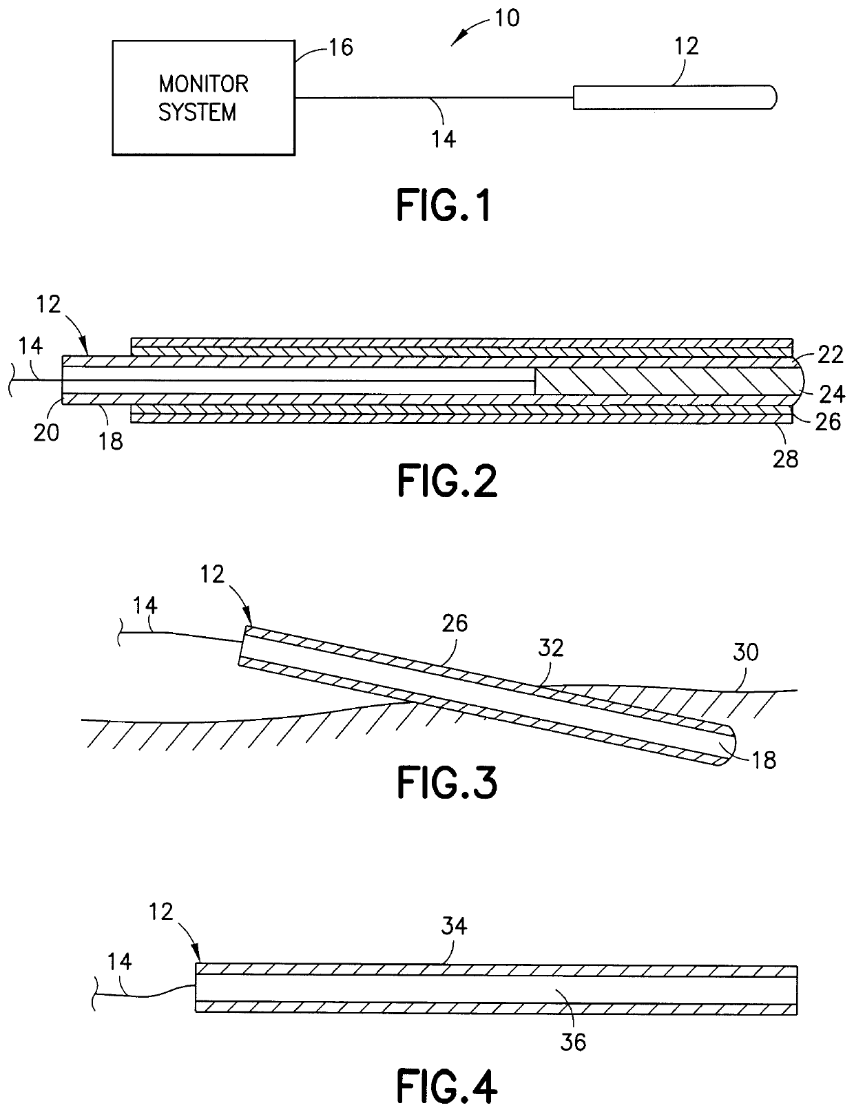 Device and method for inhibiting movement of a medical device in a patient