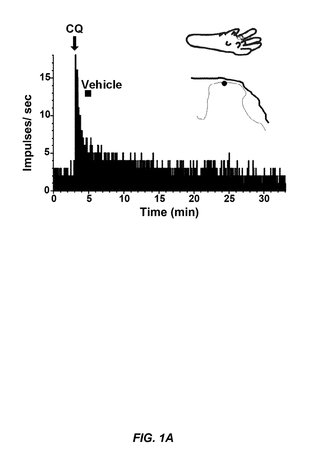 Itch treatment using a combination of neurokinin-1, gastrin releasing peptide, and glutamate receptor antagonists