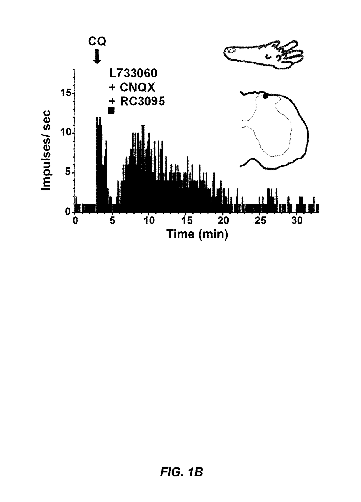 Itch treatment using a combination of neurokinin-1, gastrin releasing peptide, and glutamate receptor antagonists