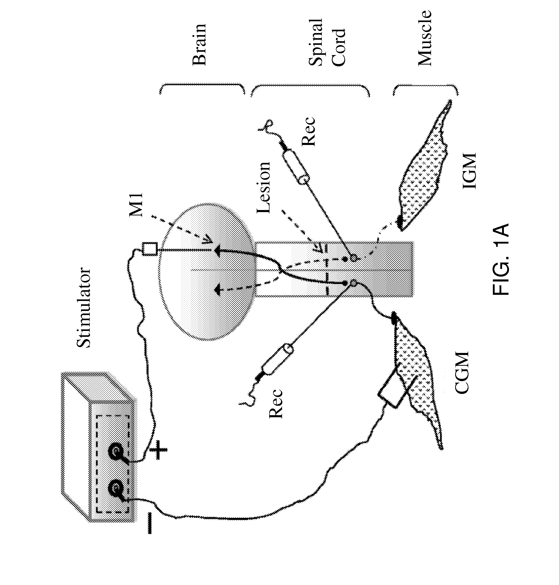 Charge-enhanced neural electric stimulation system
