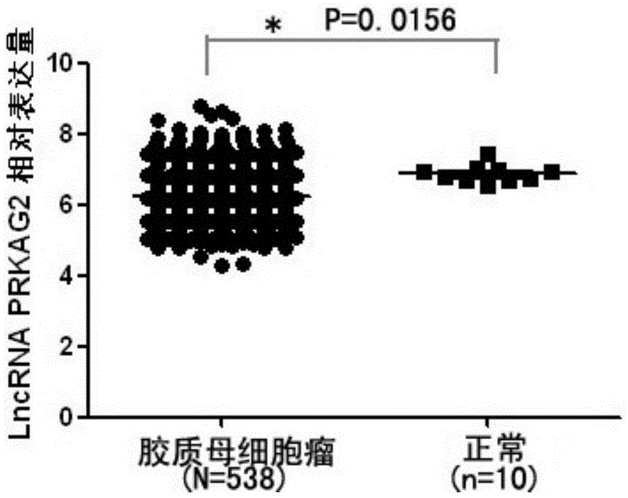 Application method of long-chain non-coding rna PRKAG2-AS1 derived from serum exosomes