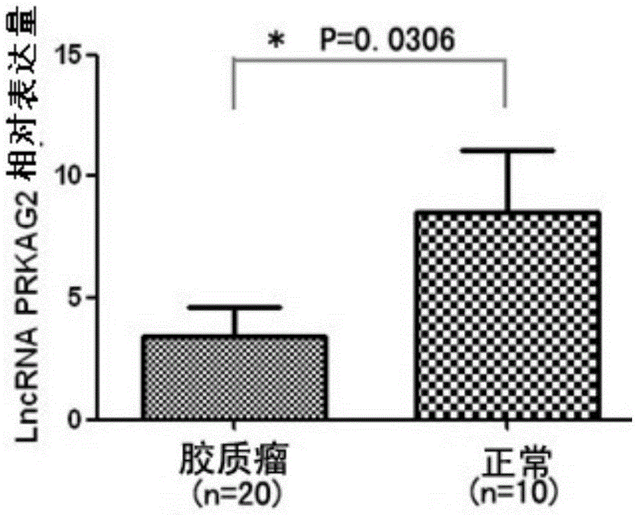 Application method of long-chain non-coding rna PRKAG2-AS1 derived from serum exosomes