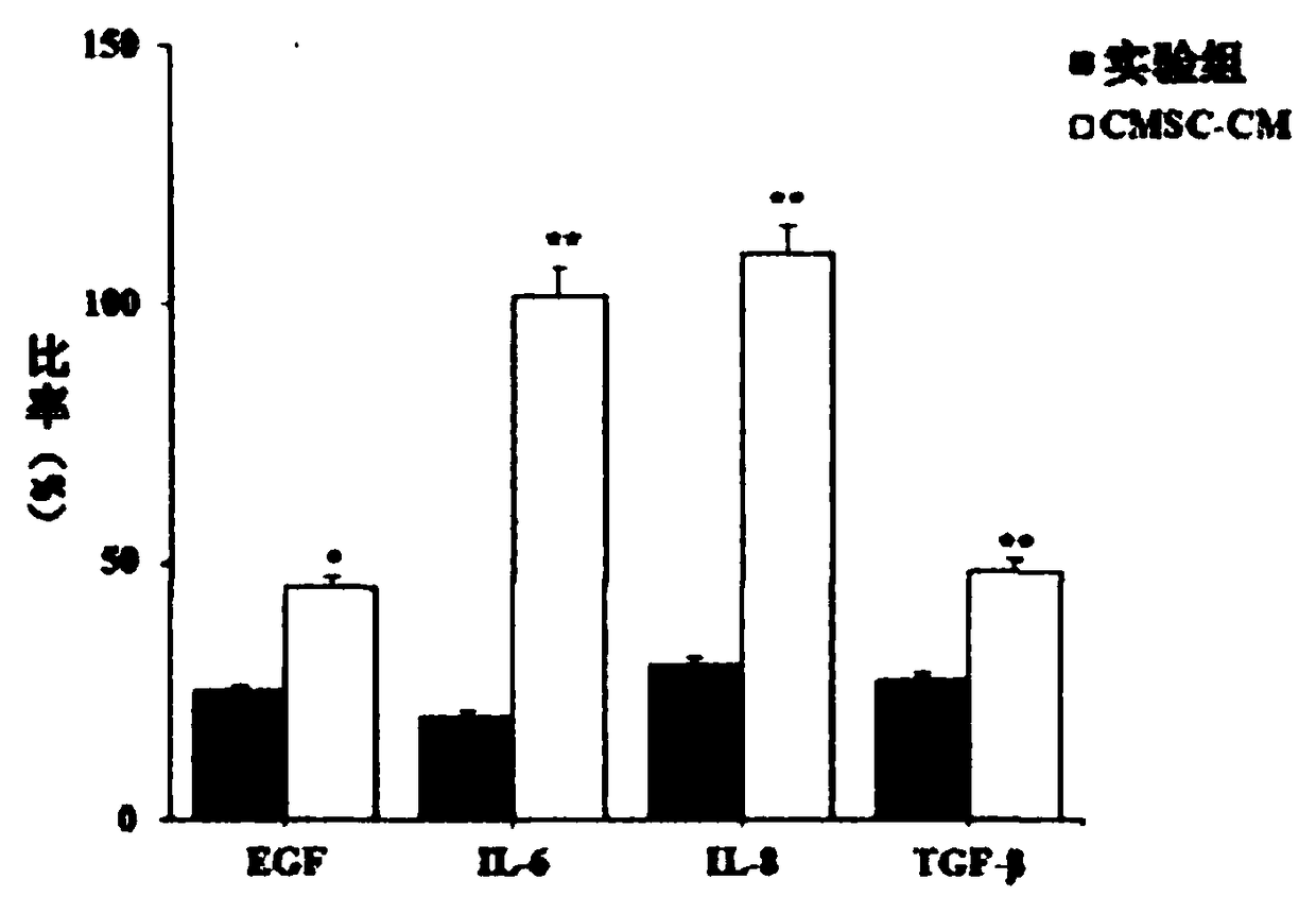 Method for preparing human chorionic stem cell culture solution and application thereof