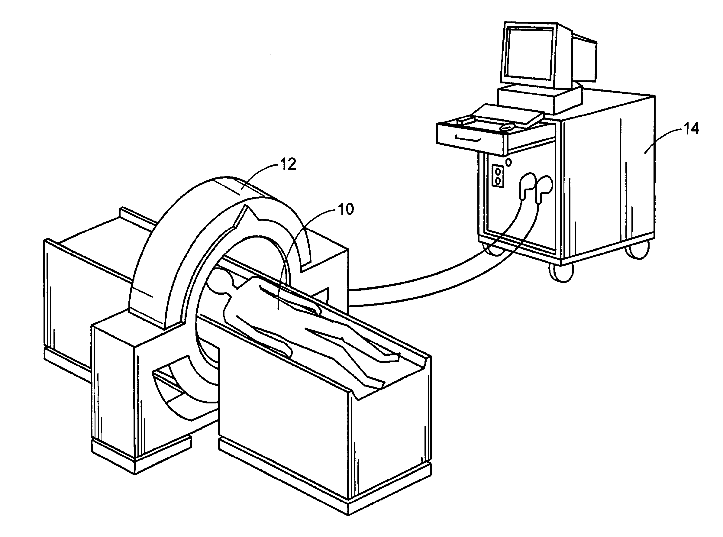 Methods and systems for producing an implant