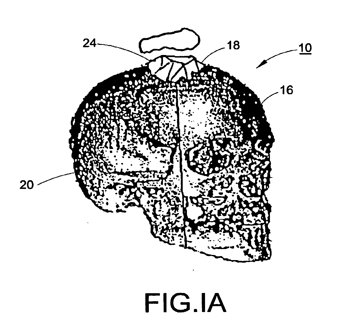 Methods and systems for producing an implant