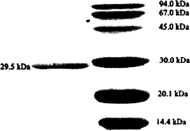 Producing basic proteinase by vibrio metschnikovii DL 33-51 strain