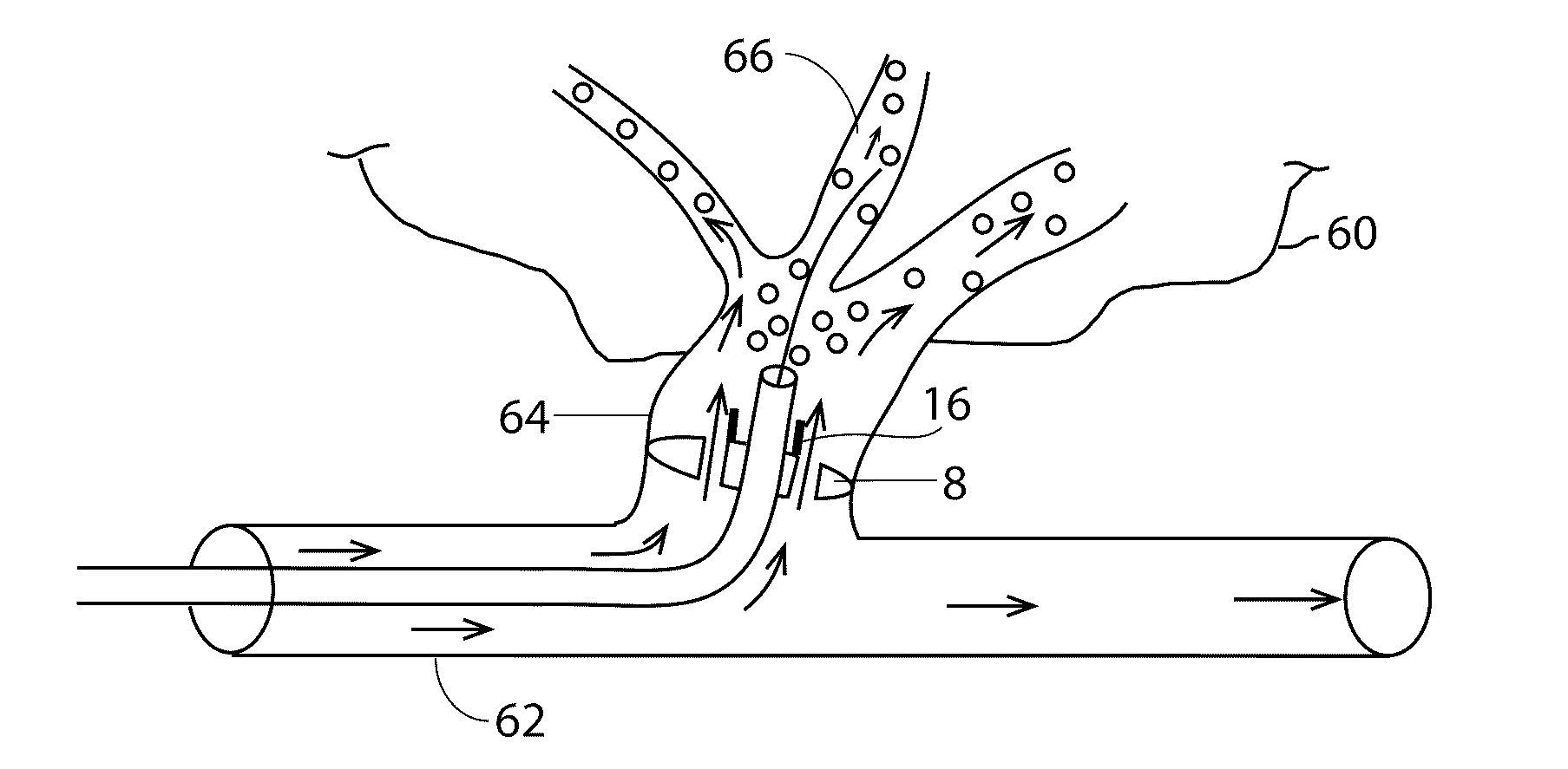 Devices and methods for low pressure tumor embolization