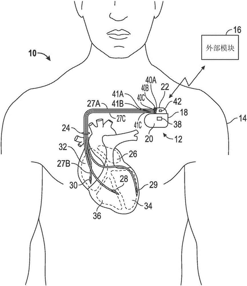 Labeled implantable medical devices