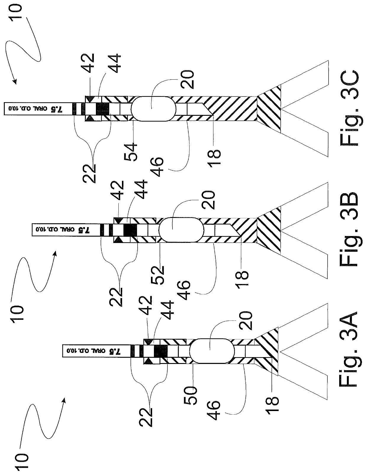 Method and apparatus for determining optimal endotracheal tube size
