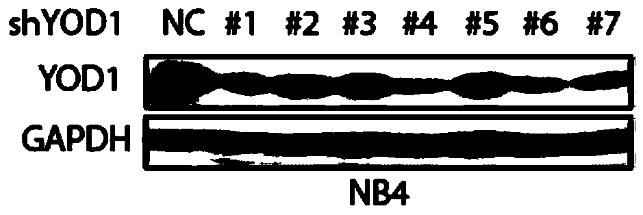 Application of YOD1 gene in preparation of leukemia induced differentiation treatment drug