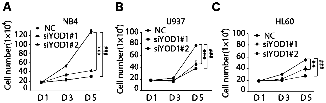 Application of YOD1 gene in preparation of leukemia induced differentiation treatment drug