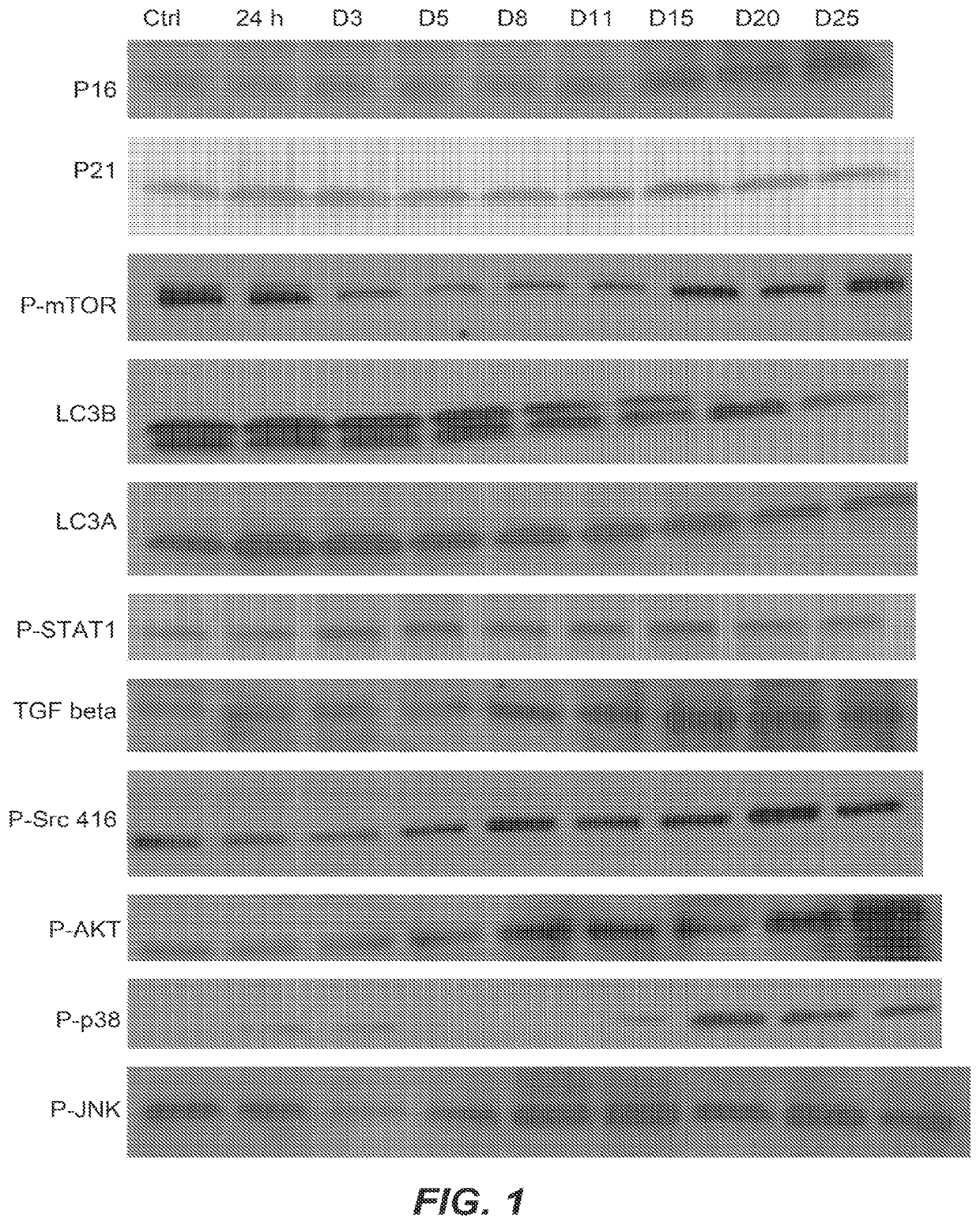 Killing senescent cells and treating senescence-associated conditions using a src inhibitor and a flavonoid