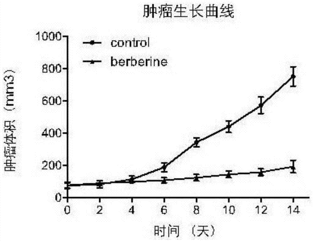 Application of berberine to preparing drug for treating B cell lymphoma