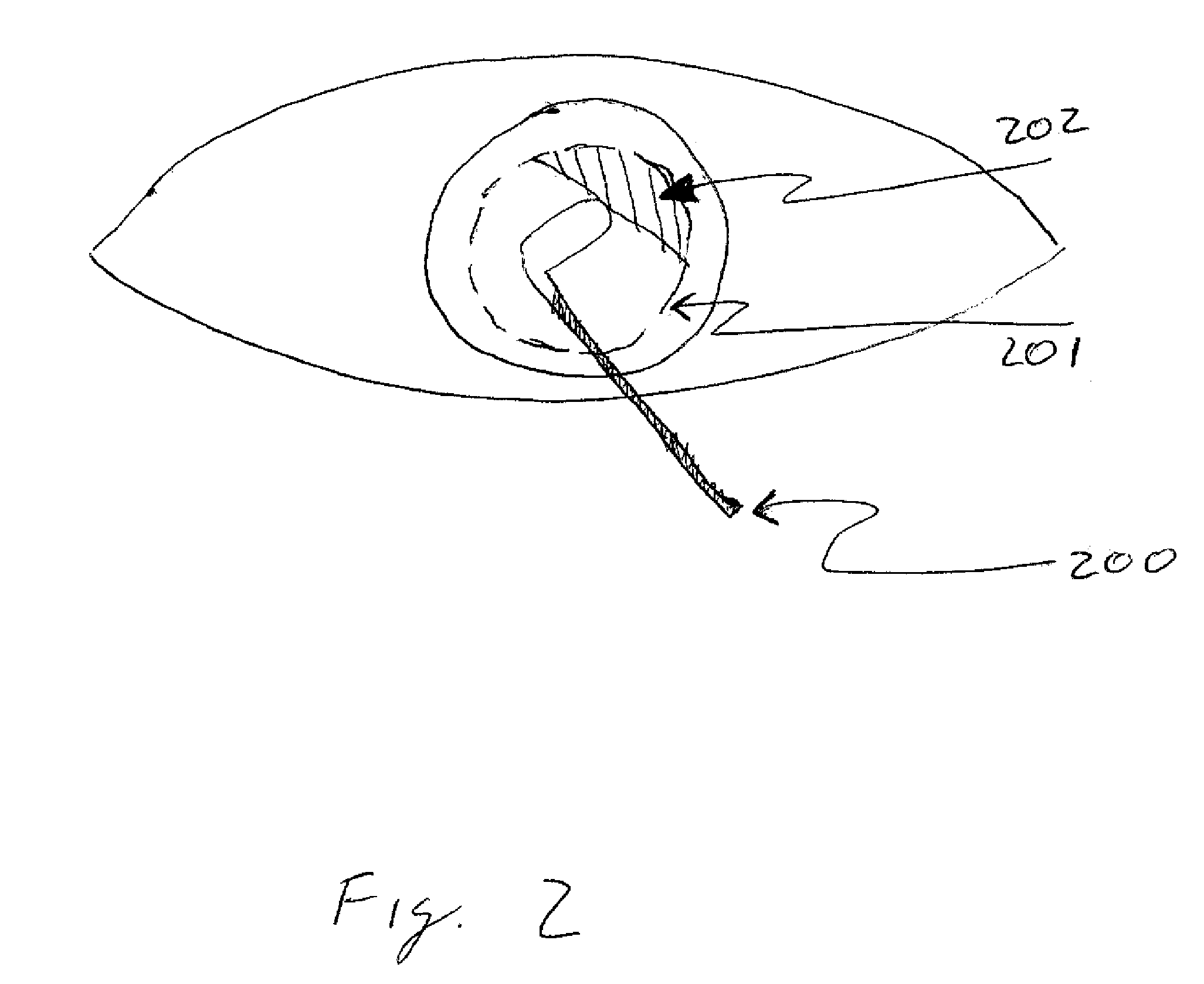 Apparatus and method for removing epithelium from the cornea