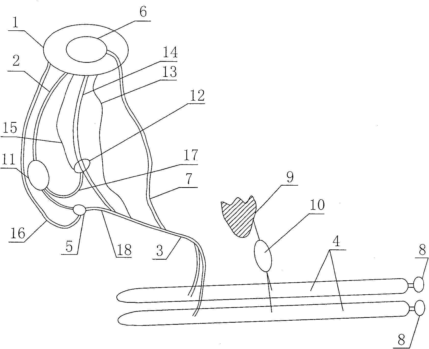 Automatic expanding device for implantation in human body