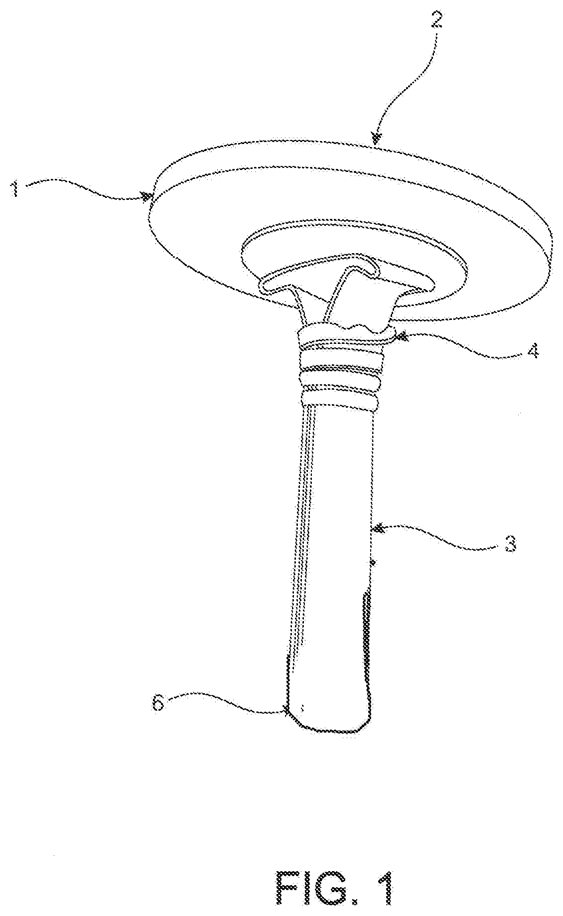 Button Anchor and Button Attachment System