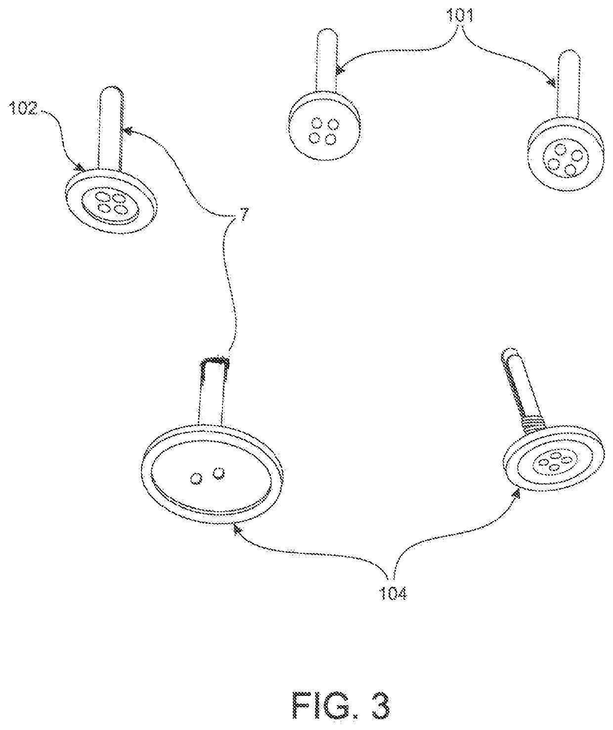 Button Anchor and Button Attachment System