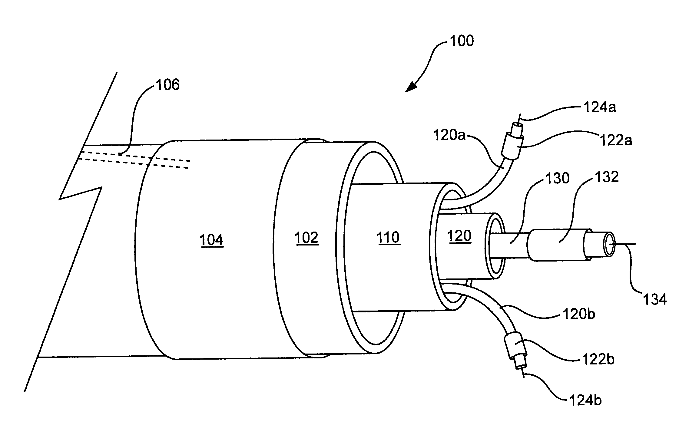 Devices and methods for treating aortic valve stenosis