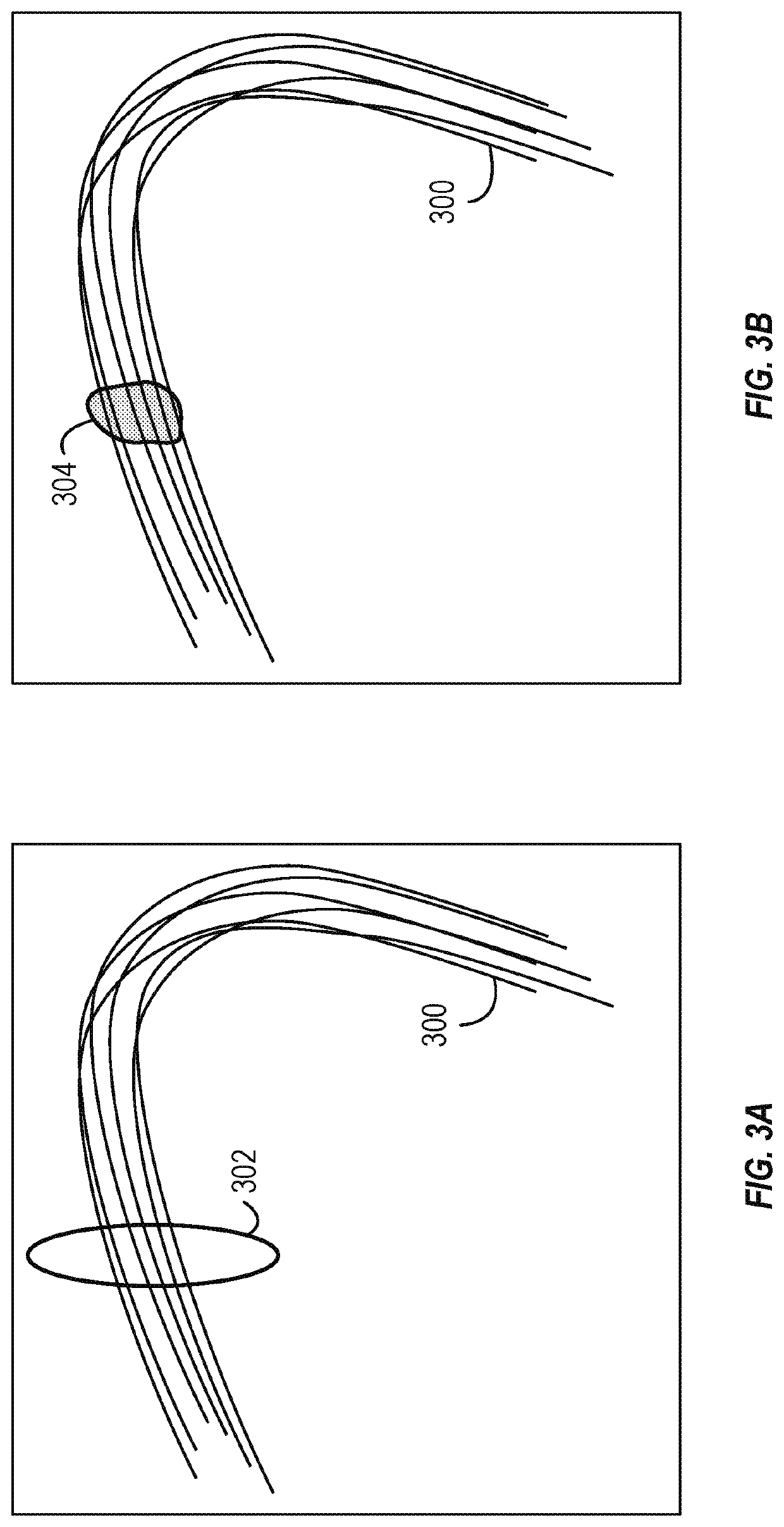 Fiber tracking and segmentation