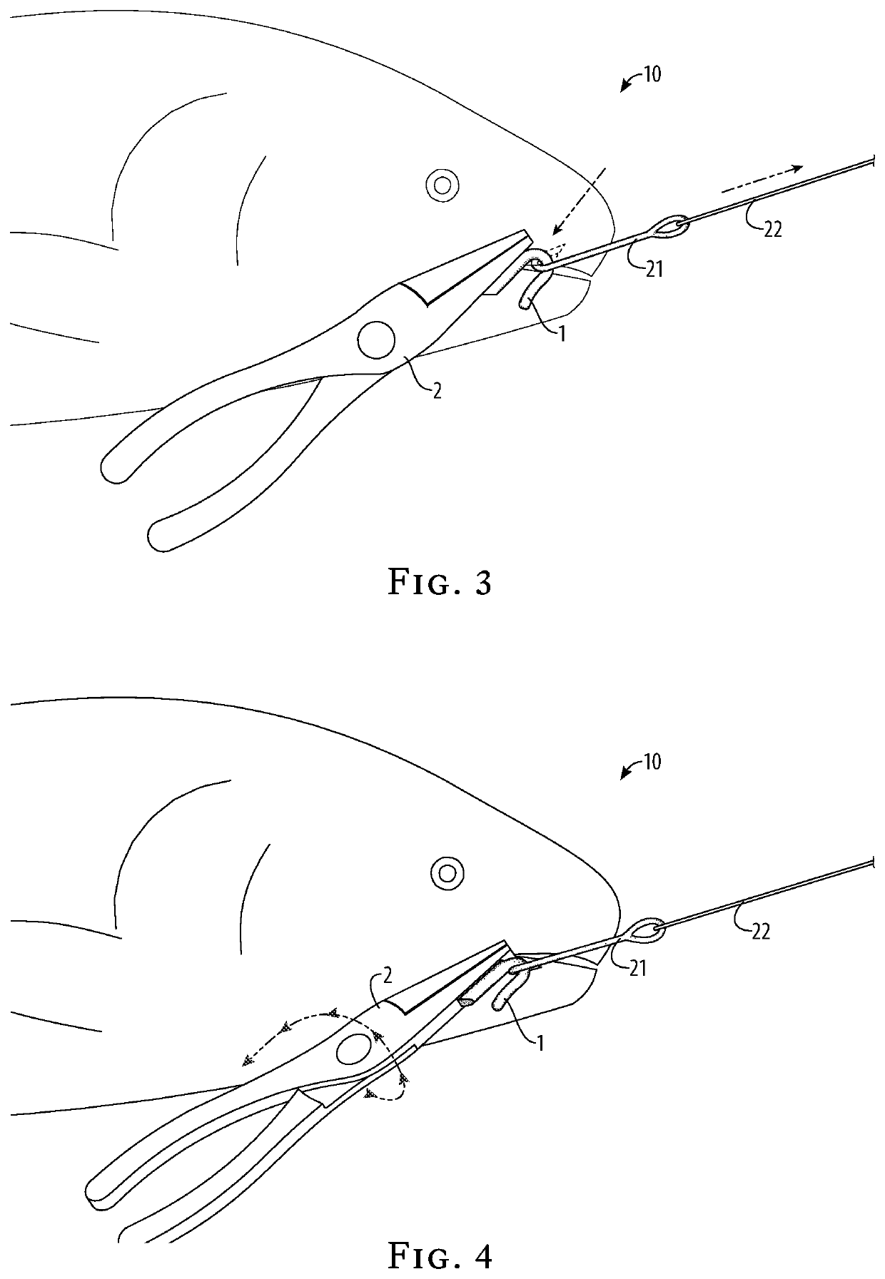 Fishhook removal device and method