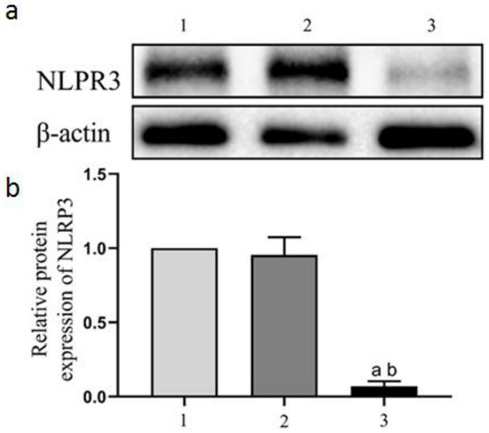 Application of EphA2 gene in preparation of product for treating or diagnosing breast cancer caused by pyroptosis-related protein