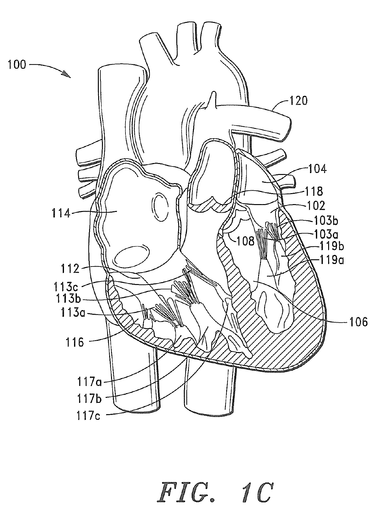 Prosthetic Tissue Valves and Methods for Replacing Native Atrioventricular Valves with Same