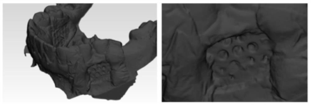 Designing and manufacturing method for personalized precise implantation of micro-implant anchorage