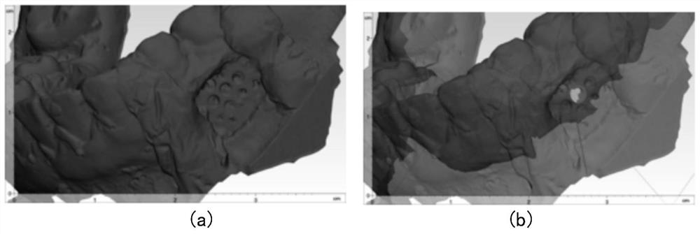 Designing and manufacturing method for personalized precise implantation of micro-implant anchorage