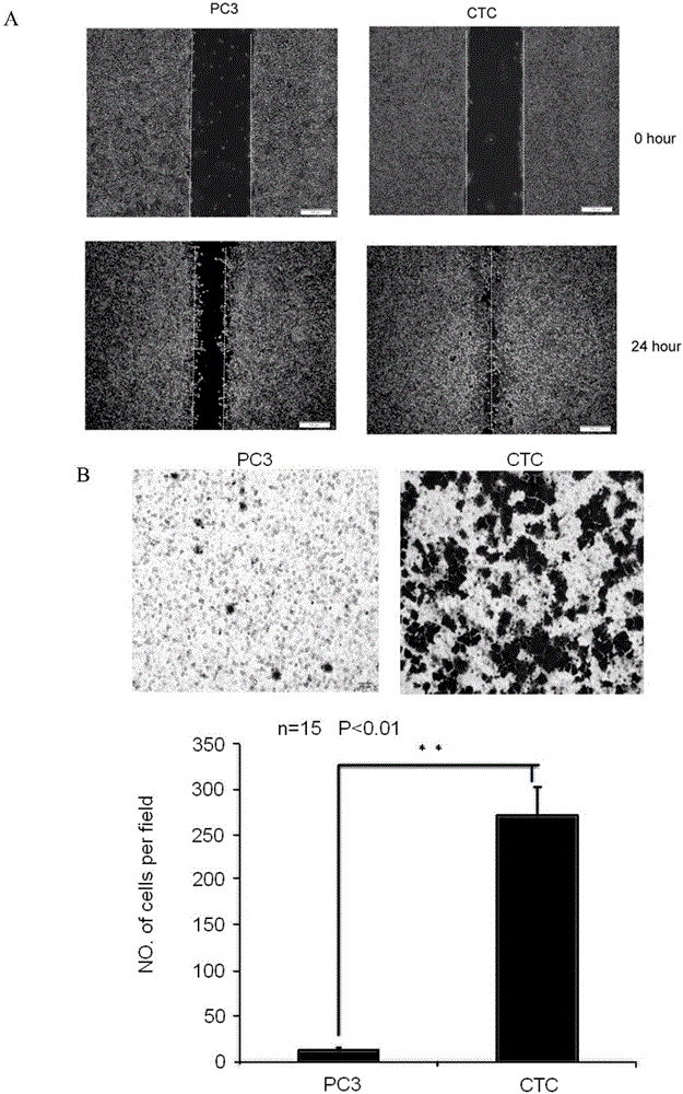 Mouse prostate cancer circulating tumor cell line and prostate cancer circulating tumor cell isolating and culturing method