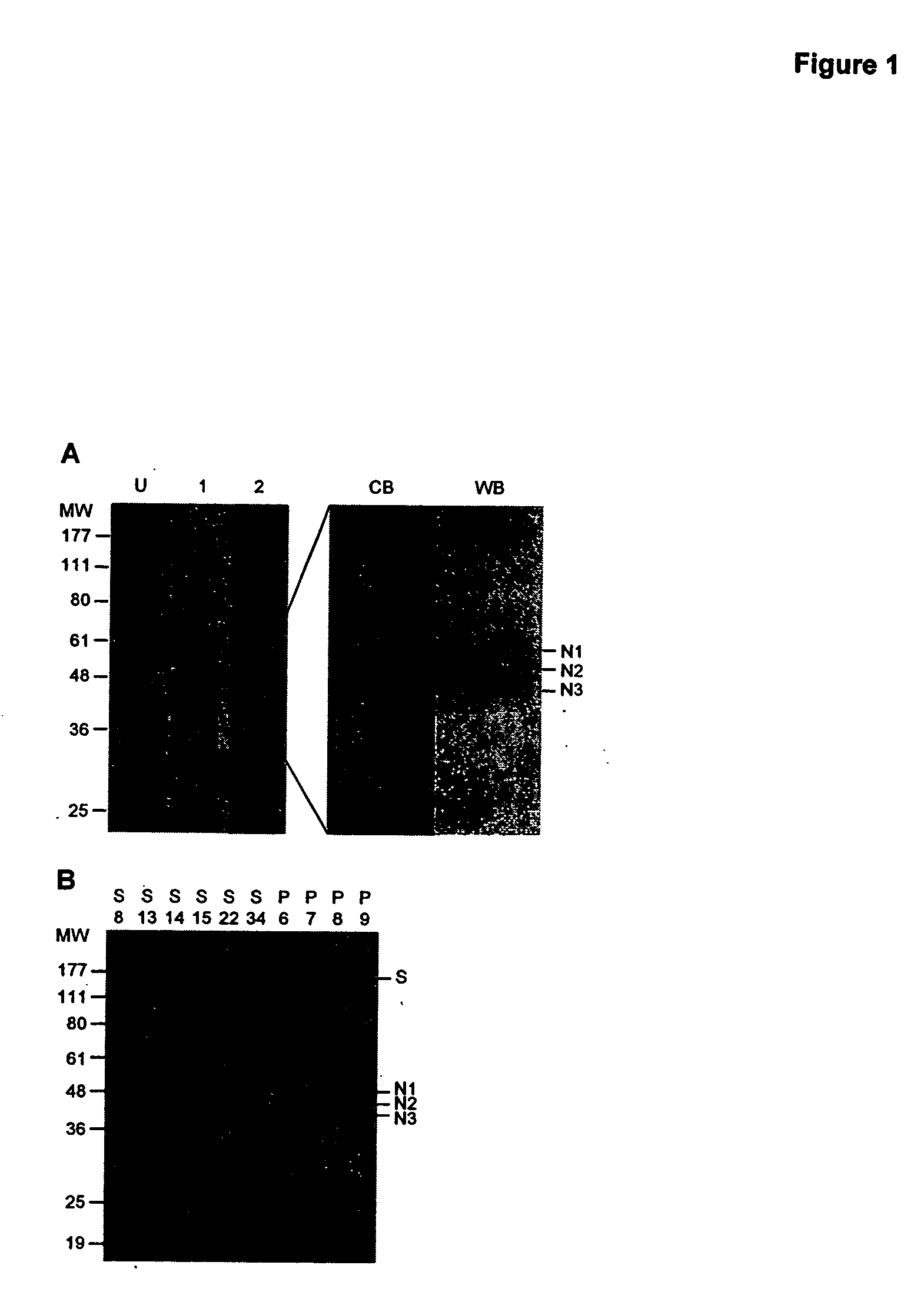 Compositions and methods for diagnosing and preventing severe acute respiratory syndrome (SARS)