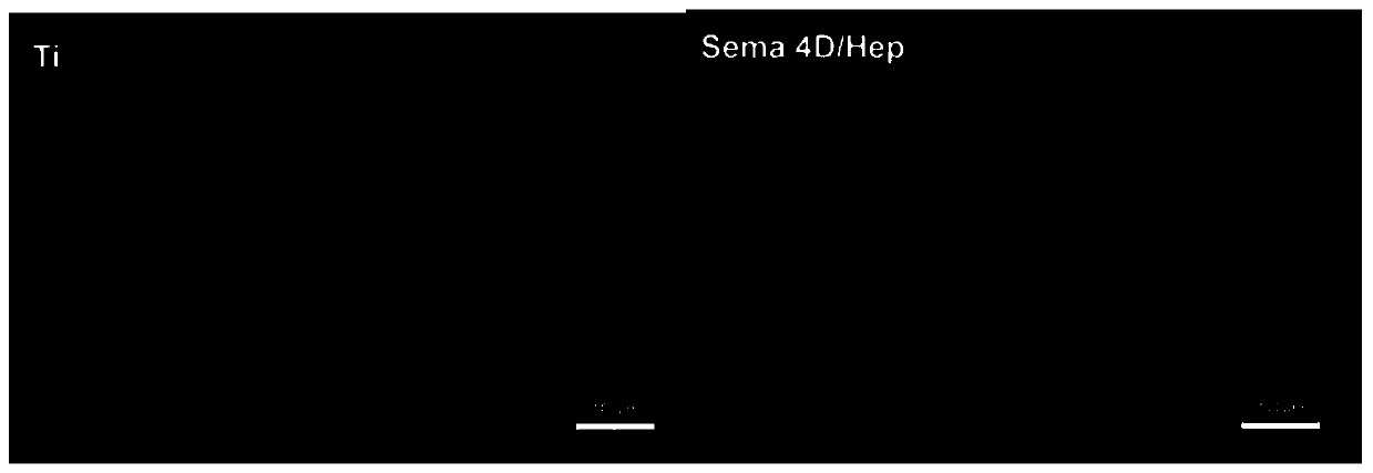 A method of constructing sema 4D/Heparin microenvironment on the surface of cardiovascular implant materials