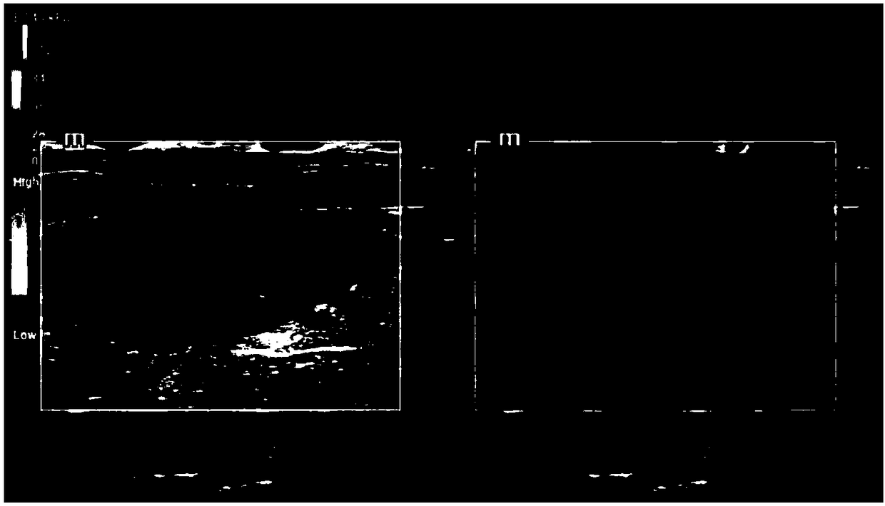 Ultrasonic elastic imaging device and elastic imaging result evaluation method