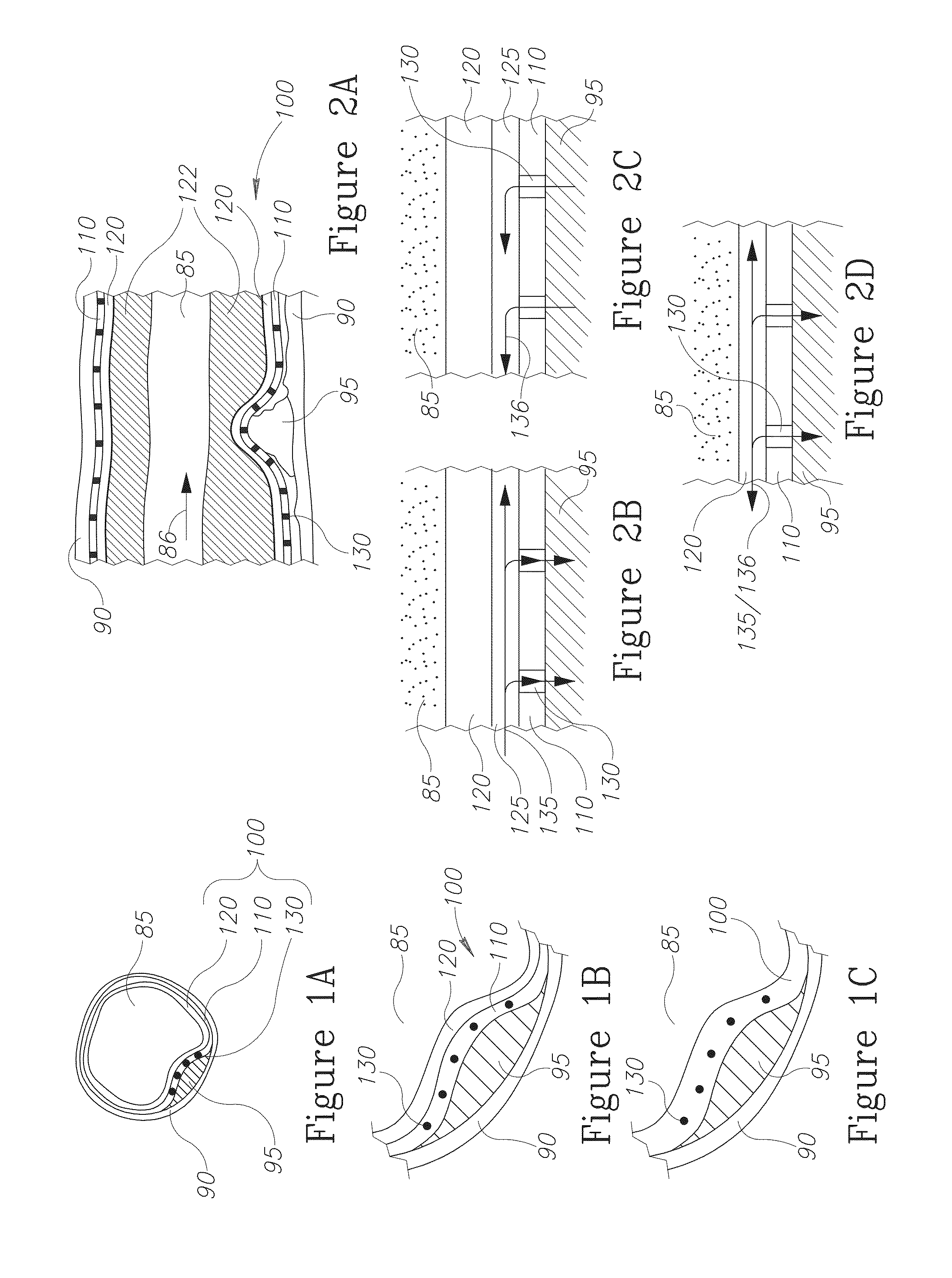 Lesion treatment device and methods for treating lesions