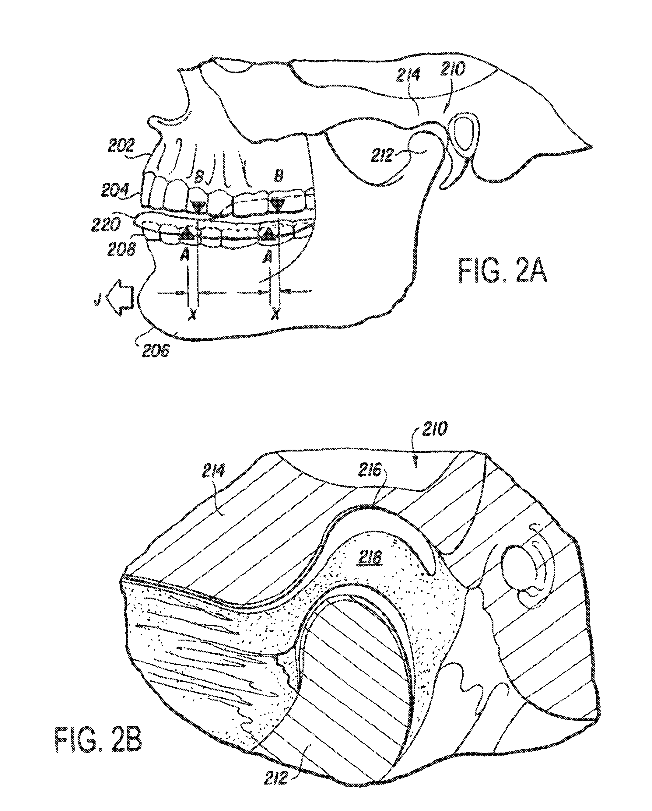 Birthing aid: method of using musculoskeletal repositioning device