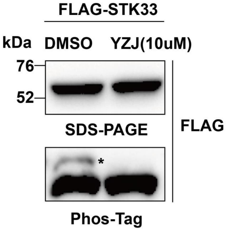 Application of kinase inhibitor in preparation of male contraceptive or product