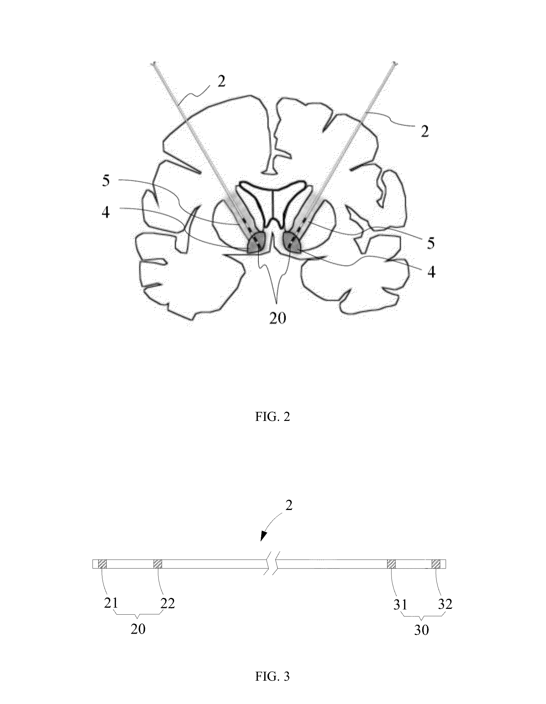 Lead, device and method for electrical stimulation of deep brain