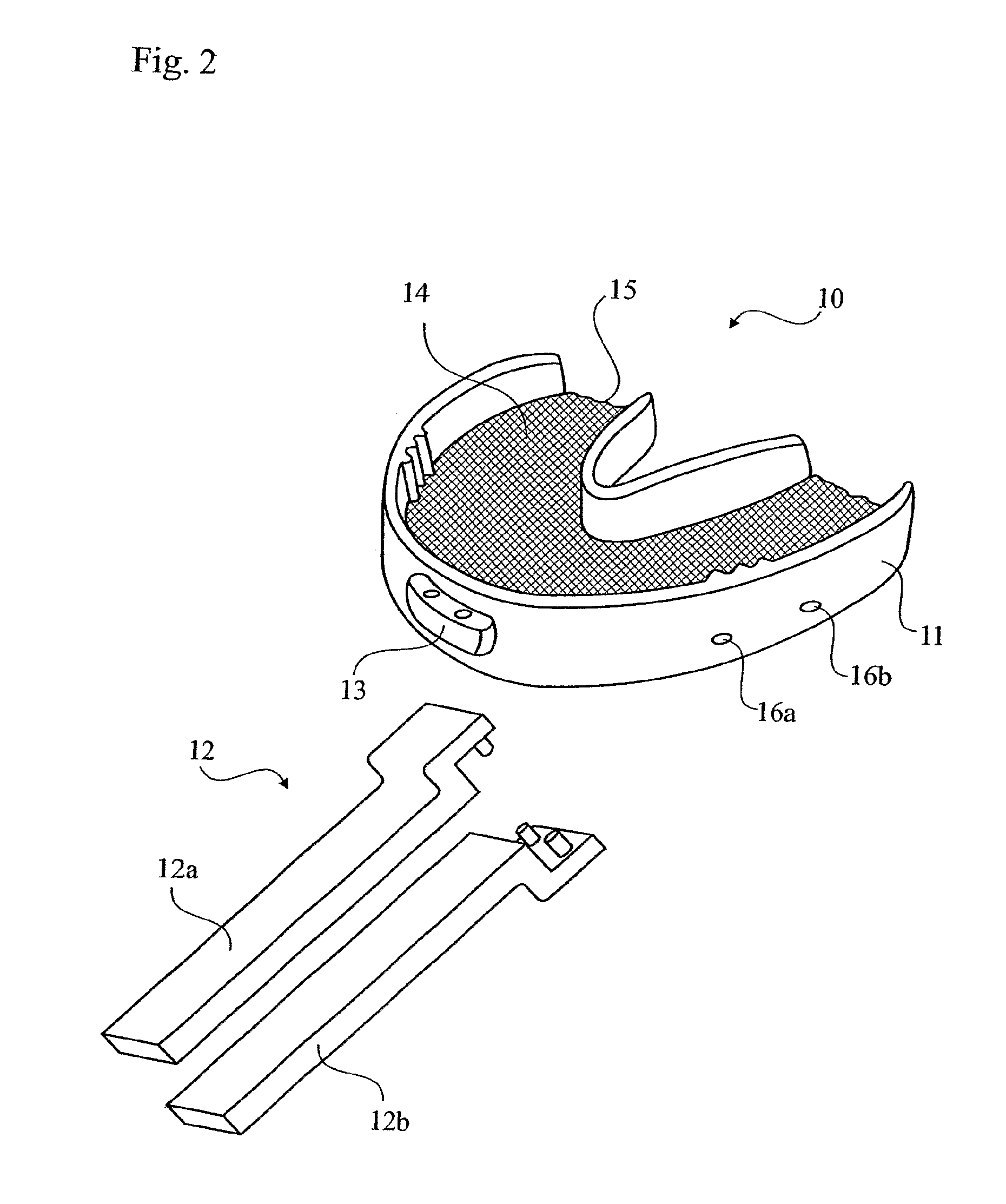 Method and apparatus for obtaining data for a dental component and a physical dental model