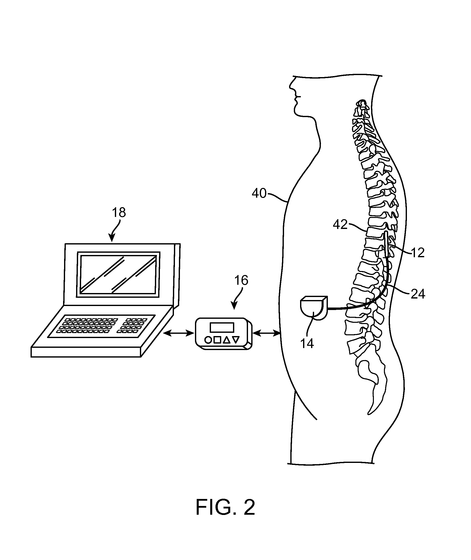 Method for selectively modulating neural elements in the dorsal horn