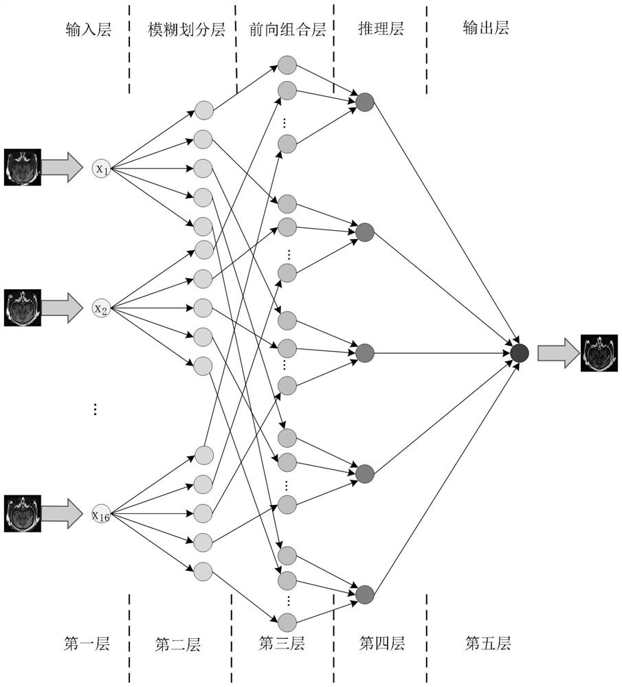 Multi-modal medical image fusion based on multi-CNN combination and fuzzy neural network