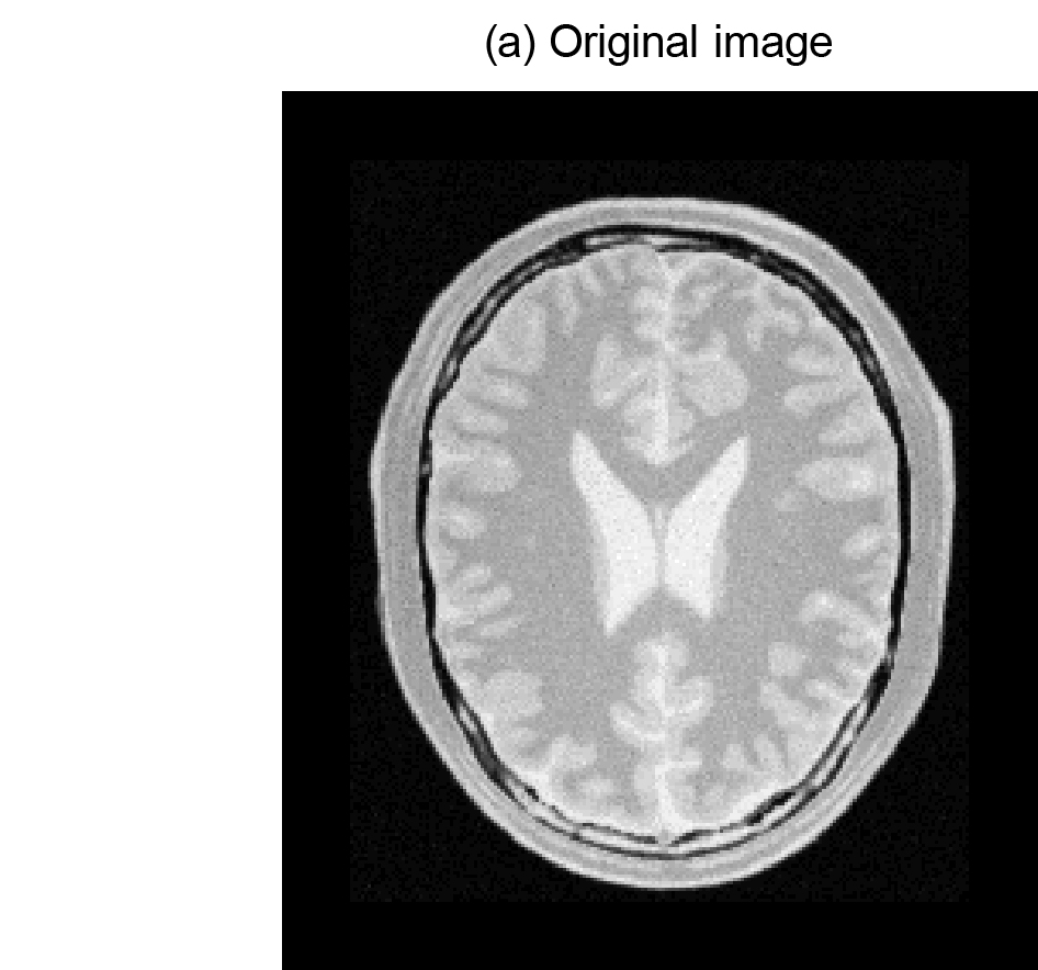 Binarization image registration method based on improved structural similarity