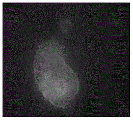 Application of salsalate compound in preparing drugs for restraining metastases and diffusion of colon cancer cells