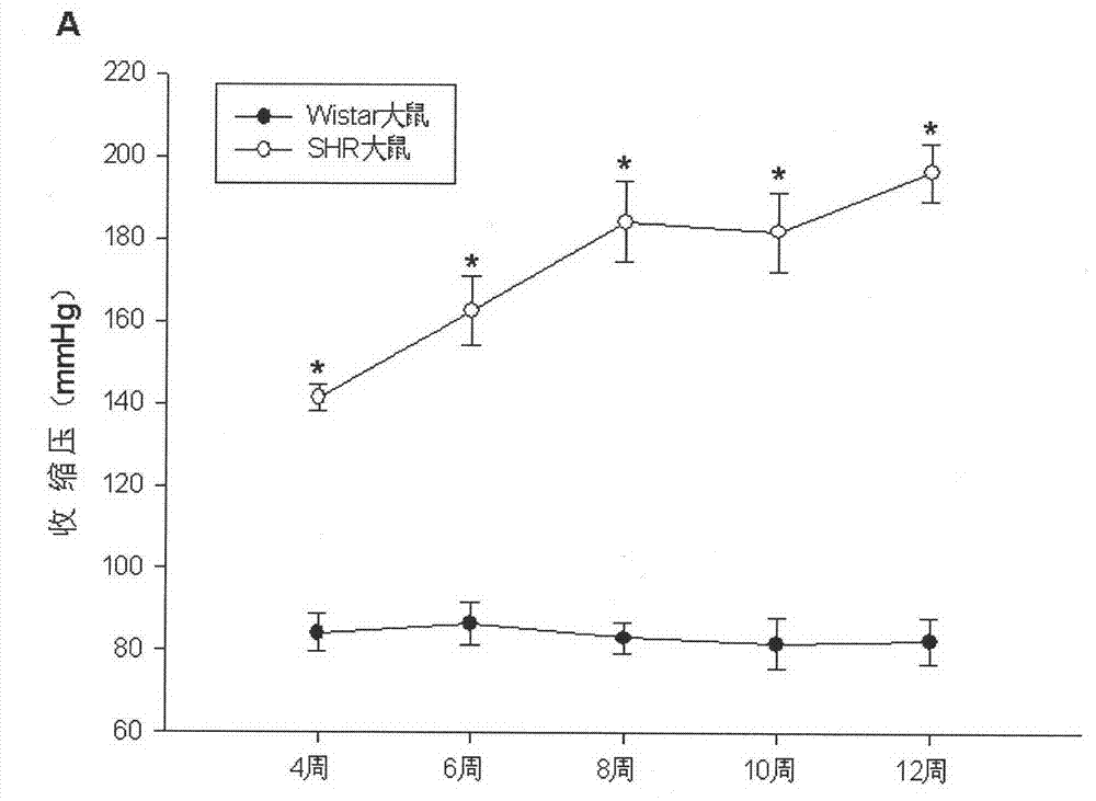 Preparation method of recombinant adeno-associated virus expressing hsa-miR-21&lt;*&gt; and application in treatment of hypertension
