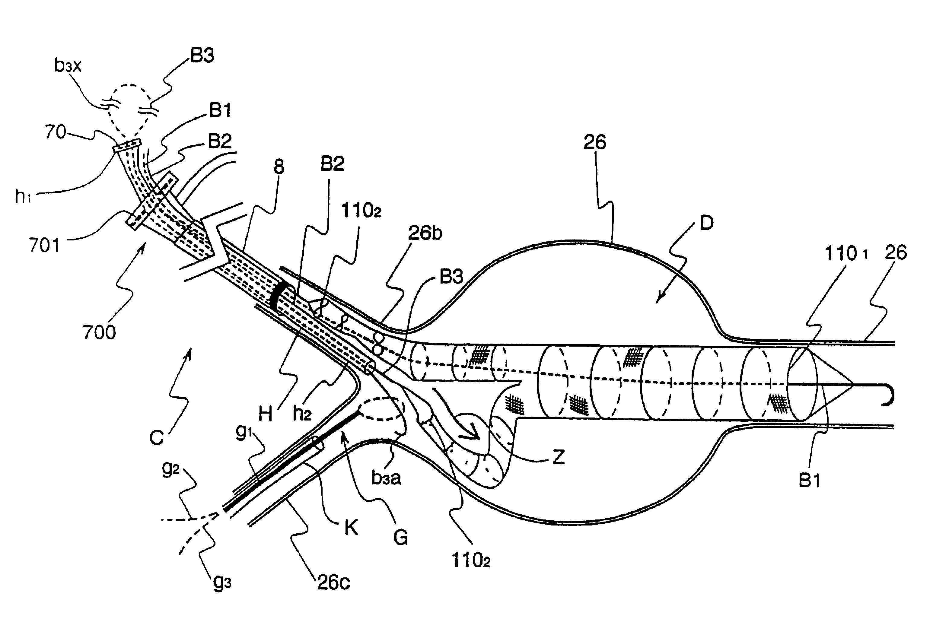 Device for handling an appliance to be implanted