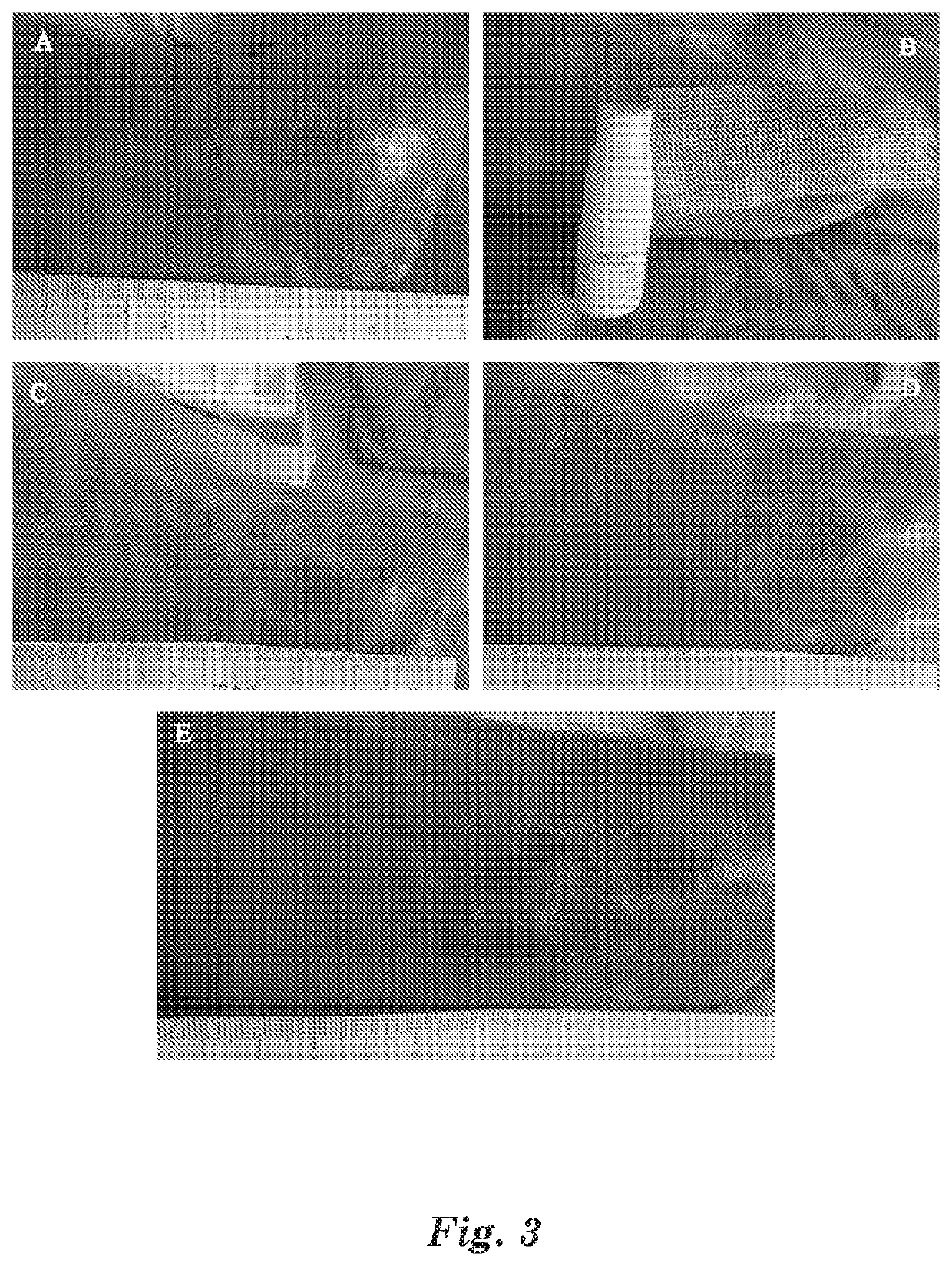 Mussel adhesive protein product and applications thereof in suppression of skin inflammations
