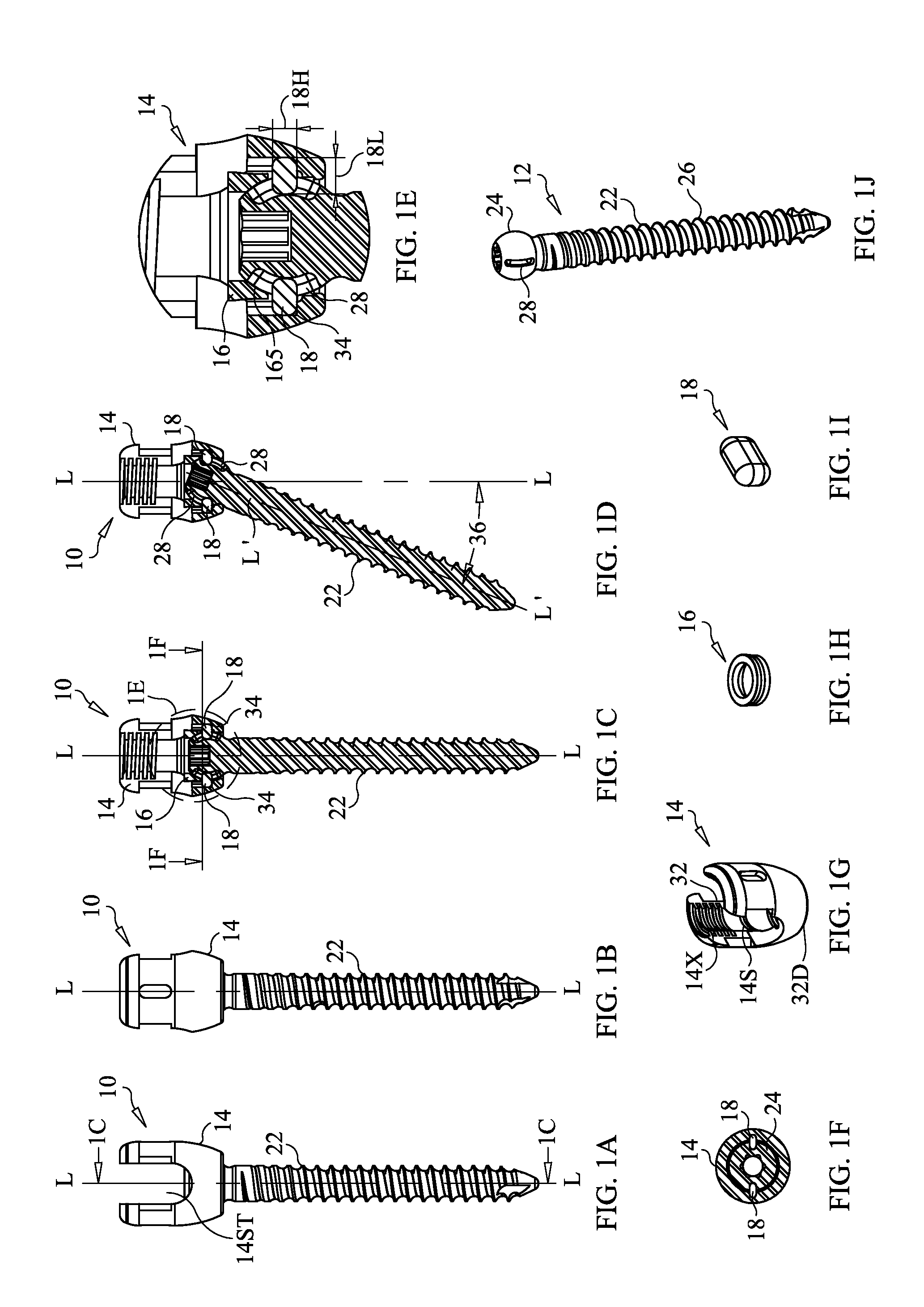 Staged Locking of Surgical Screw Assembly