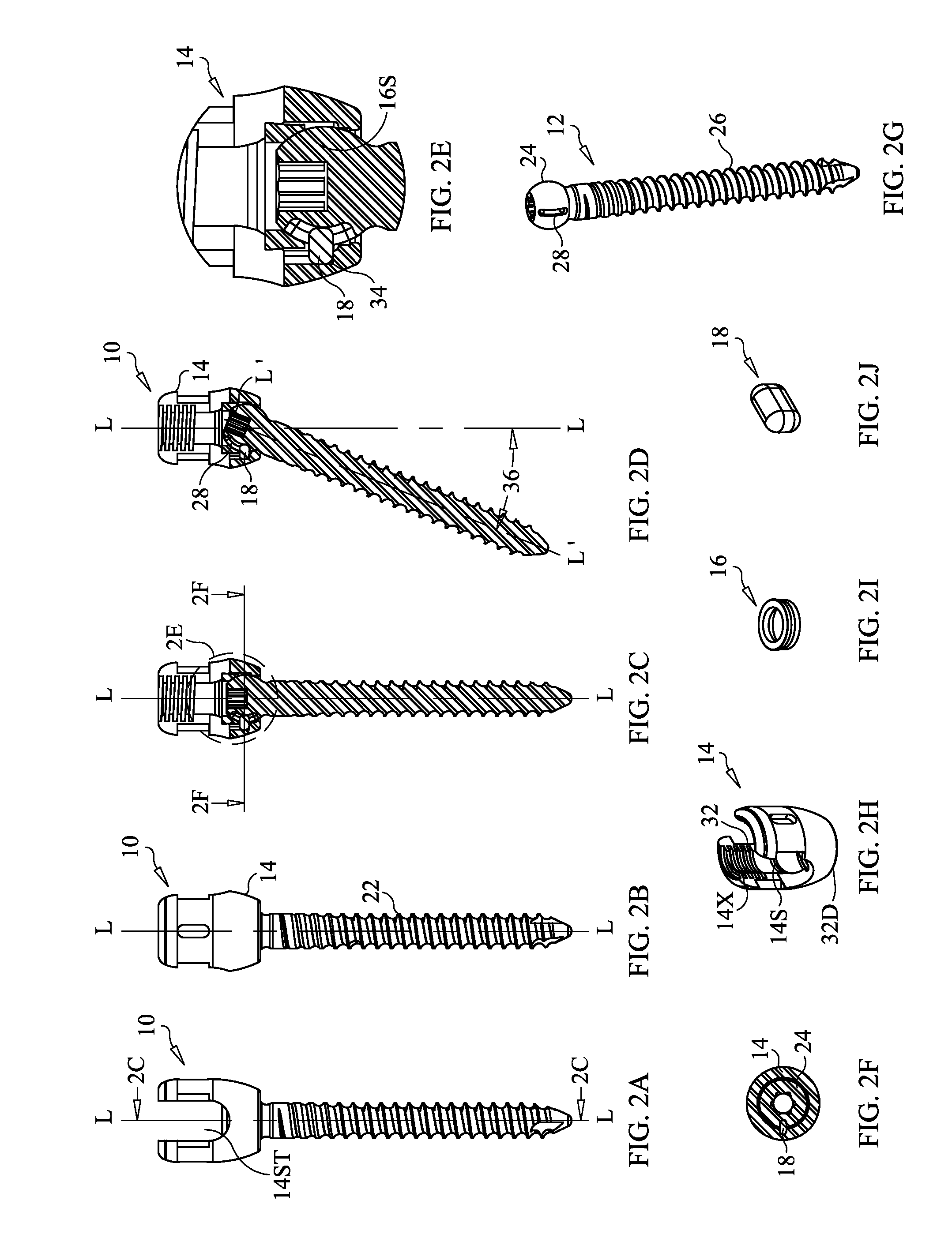 Staged Locking of Surgical Screw Assembly