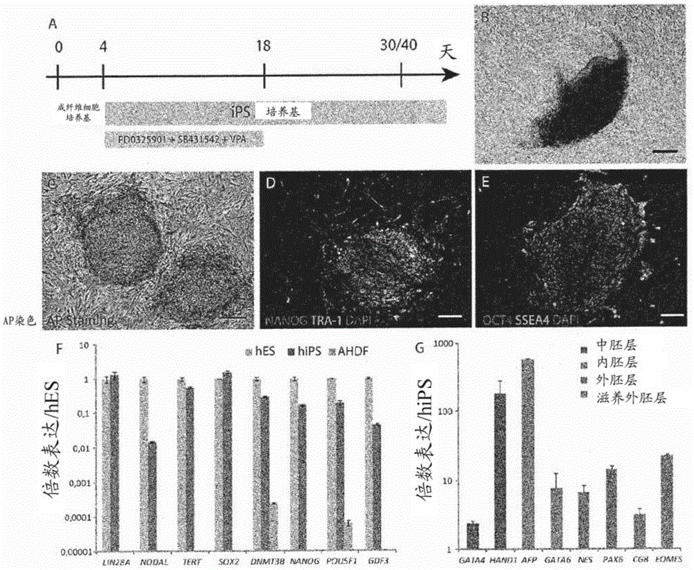 Methods for obtaining retinal progenitors, retinal pigmented epithelial cells and neural retinal cells