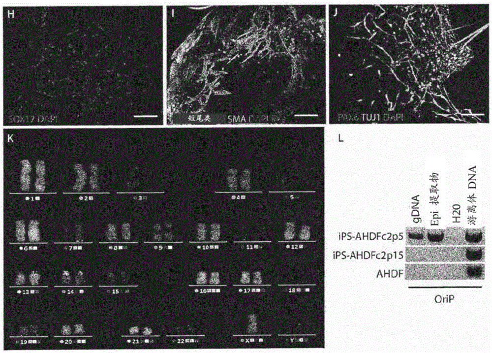 Methods for obtaining retinal progenitors, retinal pigmented epithelial cells and neural retinal cells